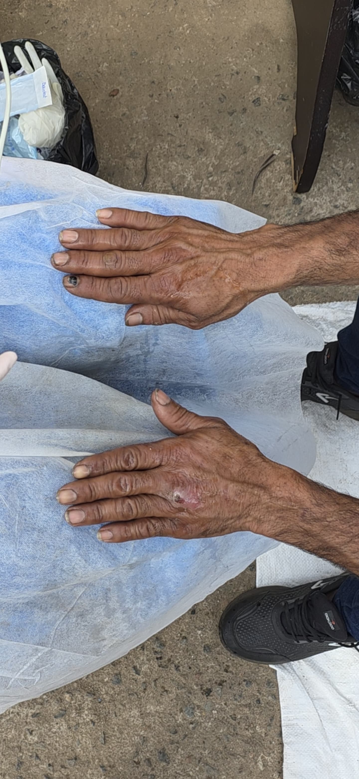 Mãos antes do tratamento