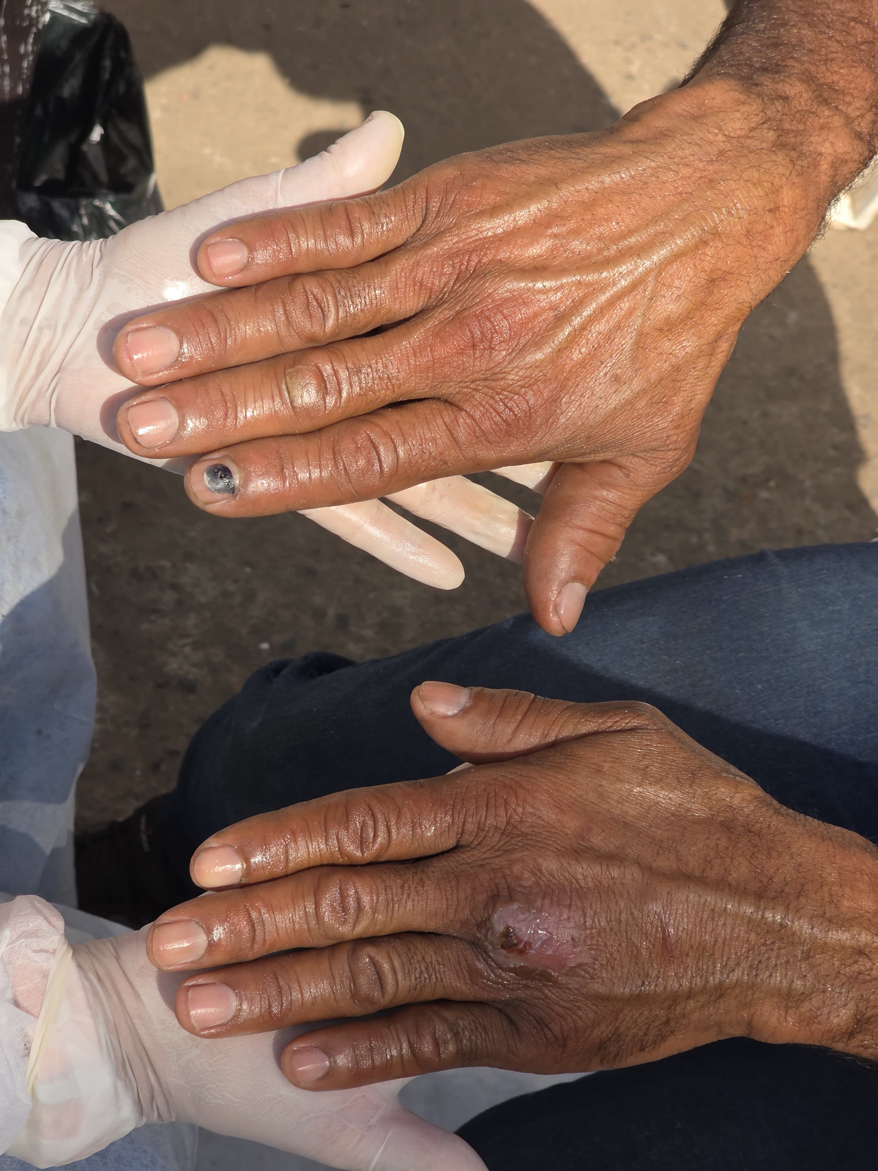 Mãos após tratamento